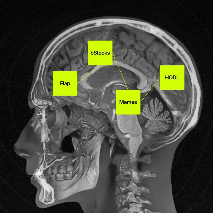 A sagittal MRI scan of a human head has been humorously annotated with sticky-note labels pointing to various brain regions: "bStocks," "Flap," "Memes," and "HODL." The annotations playfully map crypto/internet culture terminology onto brain anatomy, tying into the post's reference to "$bicat" by suggesting the character's thoughts are dominated by meme stocks, memes, and "hold" (HODL) culture.