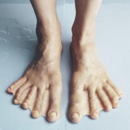 An artistic close-up photograph of a person's bare feet with unusually long, extra toes (polydactyly), standing on a light blue surface.