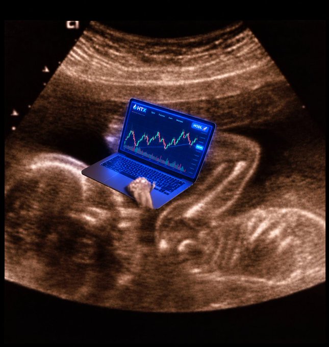 A surreal composite image shows an ultrasound scan of a fetus with a small laptop superimposed on the screen displaying a candlestick trading chart for ticker "HTX," with the caption referencing "everyone who likes this" to humorously imply crypto traders watching charts like a baby in the womb.