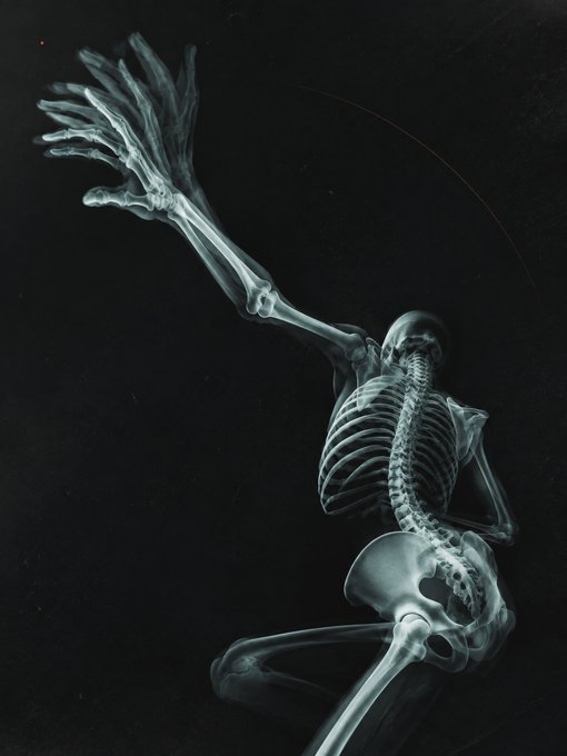 An X-ray style image depicts a human skeleton posed dynamically with one arm reaching upward against a dark background.