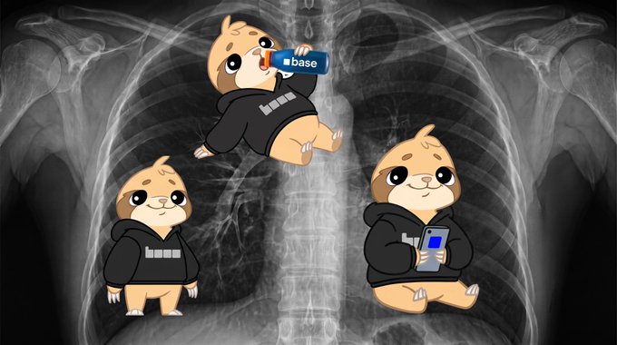 A chest X-ray with three cartoon shiba inu mascots in black hoodies superimposed over the ribs — one drinking from a "Base" branded cup, one standing empty-handed, and one holding a blue phone — visually representing a "degen" lifestyle obsessed with the Base blockchain network, playing on the "in me" punchline.