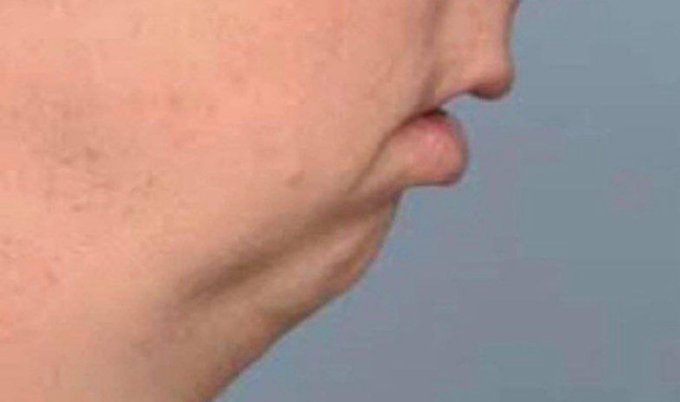 A close-up side profile of a man's lower face showing stubble and his lips against a gray background.