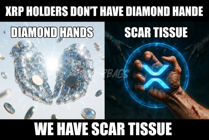 Crypto meme titled 'XRP Holders Don't Have Diamond Hands, We Have Scar Tissue' contrasting 'Diamond Hands' with crystal hands versus 'Scar Tissue' showing a wounded hand holding an XRP logo.