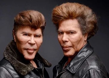 The image depicts two men who appear to be the result of extreme, exaggerated cosmetic surgery, with oversized lips and puffed features reminiscent of human face transplants gone wrong. The caption "We all know how this ends" suggests a grim or humorous warning about the consequences of such drastic procedures, implying that the outcome—distorted, unnatural appearances—is inevitable when vanity is taken to such extremes.
